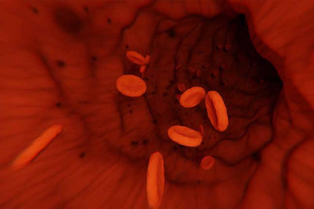 Did you know that not all LVDS platelets are the same? thumbnail